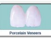 Porcelain Veneers